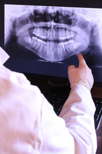 Best Emergency Tooth Extraction in Clearlake, CA